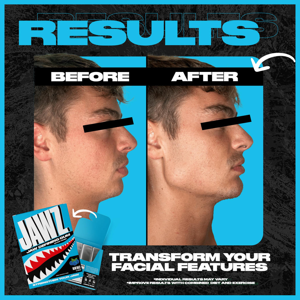 Jawz Gum defining jawline highlights sculpted features.
