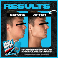 Jawz Gum defining jawline highlights sculpted features.
