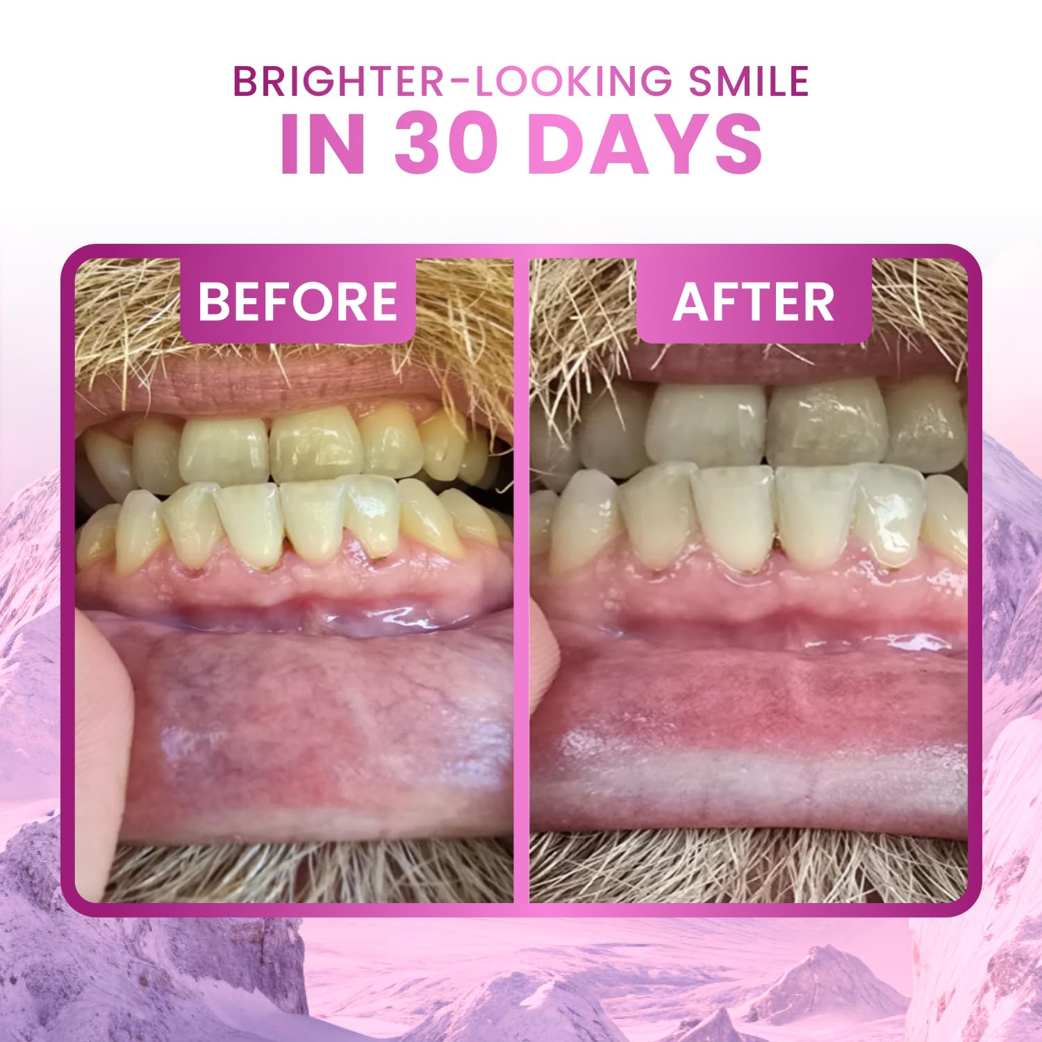 Larineco Remineralizing Gum no-dyes close-up emphasizes natural ingredients and clean flavor.